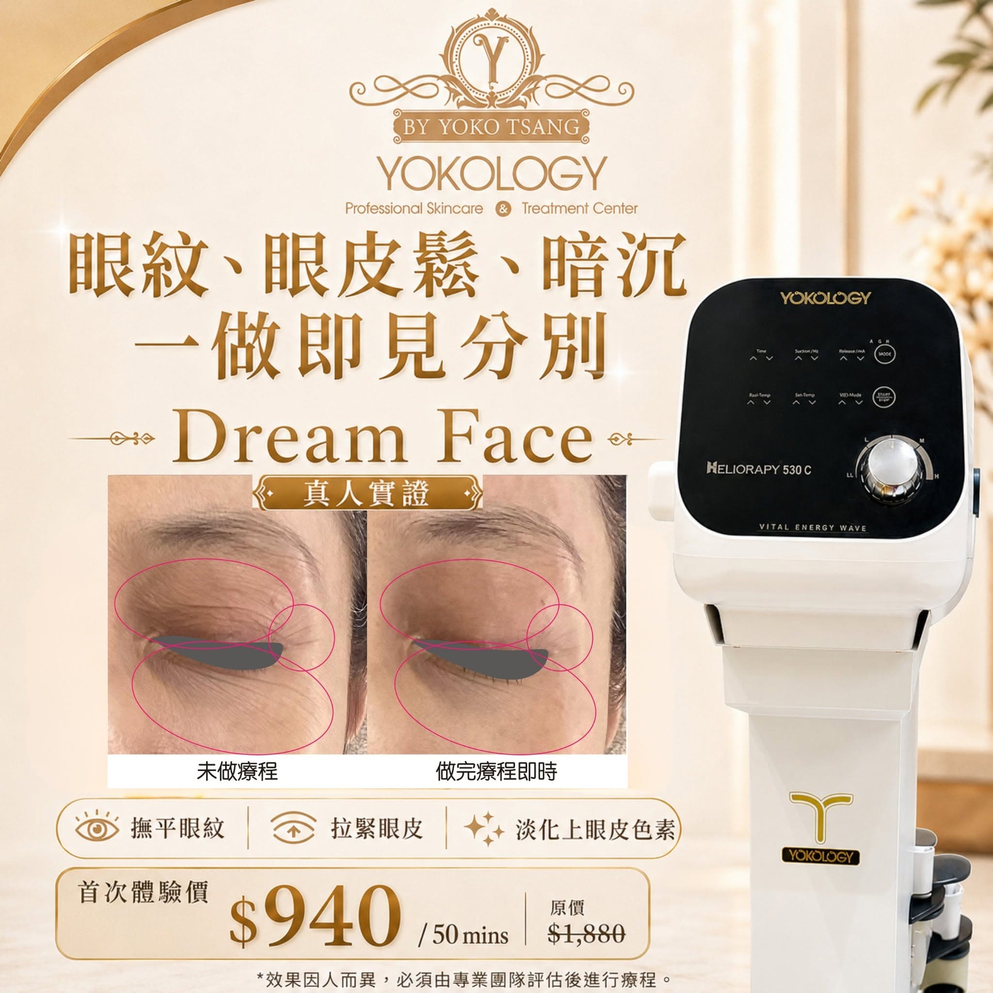 Dream Face 超量子 真實案例 1 / 2